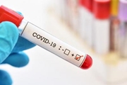 آیا سیستم ایمنی می تواند COVID-19 را درمان کند؟